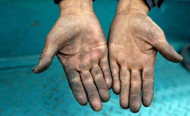 2021年農(nóng)村大發(fā)展，四個項目投資少利潤高，管理好一年30萬