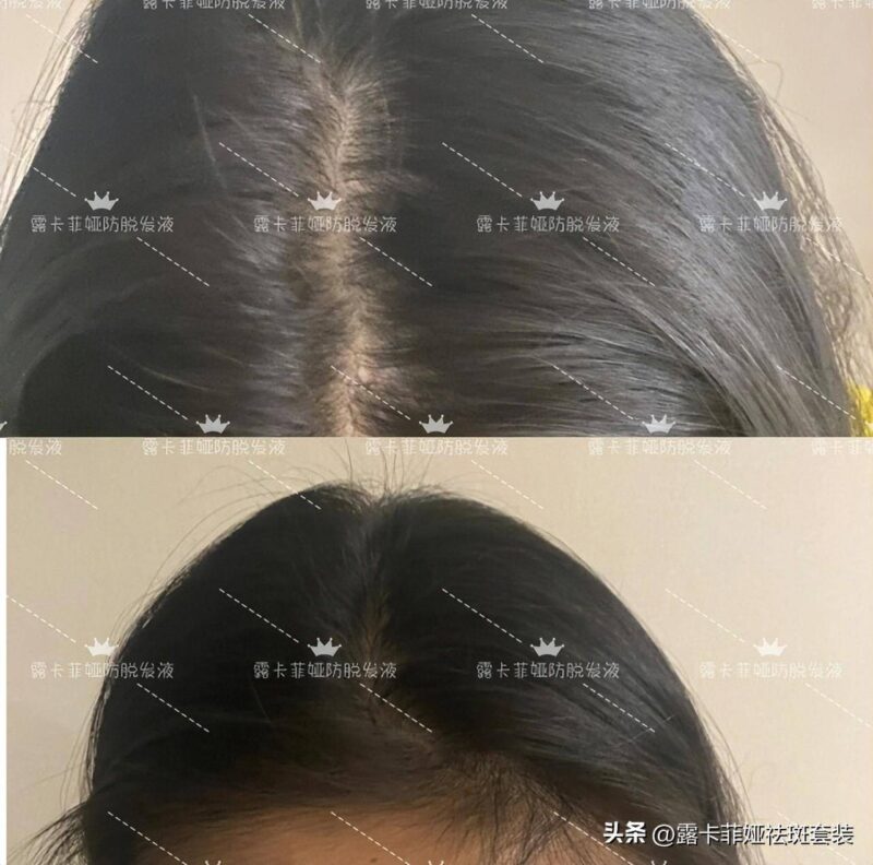 洗發(fā)水品牌排行榜前十名不掉頭發(fā)-1 洗發(fā)水品牌排行榜前十名不掉頭發(fā)-1